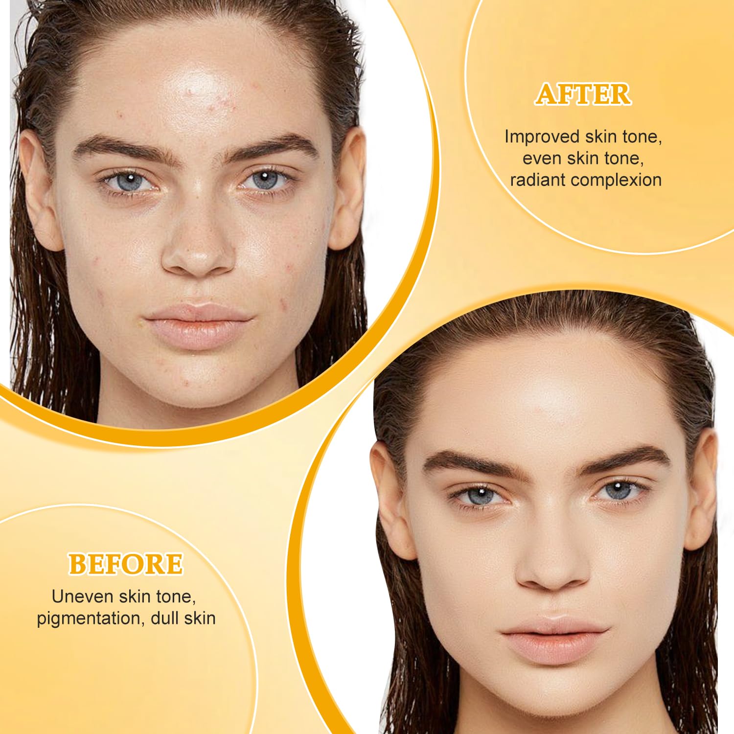 Honey Glow Lemon Turmeric Kojic Soap Bar, Honey Glow Turmeric Soap, Lemon Kojic Soap, Turmeric Soap Bar for Face & Body, Natural Turmeric Handmade Soap for All Skin Types (2) - Image 5